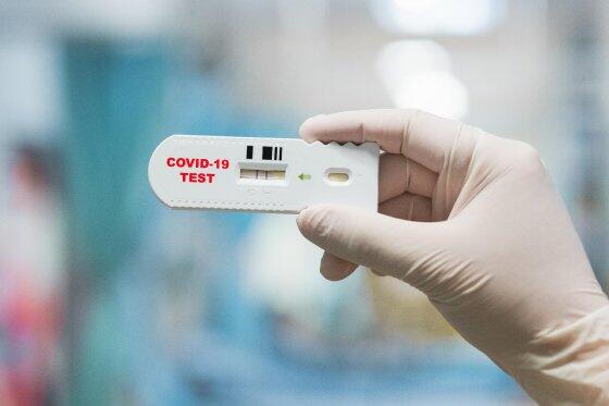 teste covid.jpg