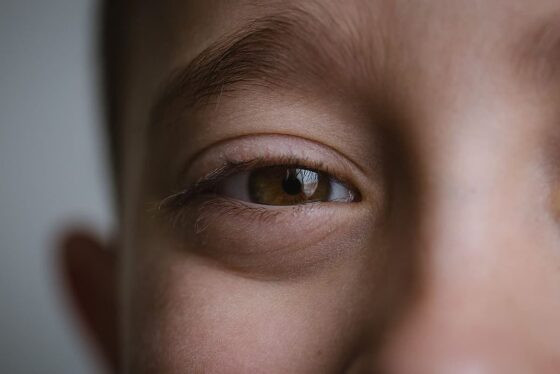 doença ocular.jpg