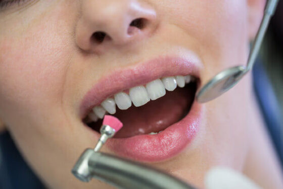 tratamento dentário.jpg