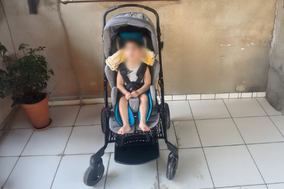 criança com microcefalia.jpg