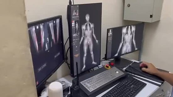 bodyscanner.jpg
